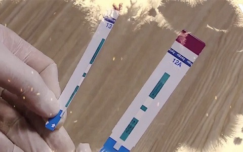 Vụ cắt đôi que thử HIV ở BV Xanh Pôn: Sẽ điều tra nếu có dấu hiệu hình sự