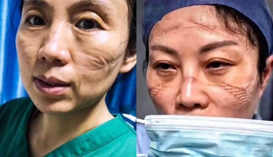 Những hình ảnh xúc động trong “cuộc chiến” chống virus corona
