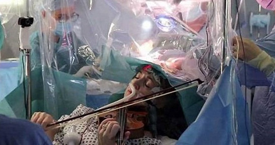 Một bệnh nhân chơi vĩ cầm trong khi phẫu thuật u não