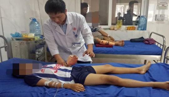 Điện thoại phát nổ, bé trai 12 tuổi bị dập nát bàn tay