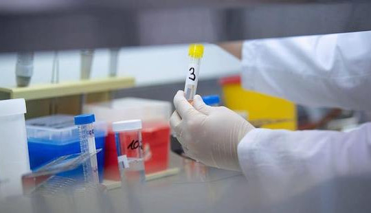 Thêm 3 bệnh viện ở TP.HCM được xét nghiệm Covid-19