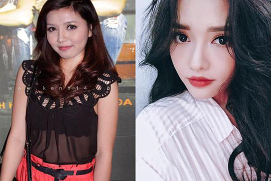 Bích Phương thừa nhận sửa mũi & cằm sau nhiều năm im lặng