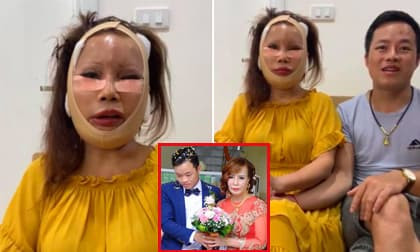 'Cô dâu 62 tuổi' lại tiếp tục đại trùng tu nhan sắc, chẳng ngại livestream cùng chồng trẻ khi ngoại hình xấu nhất