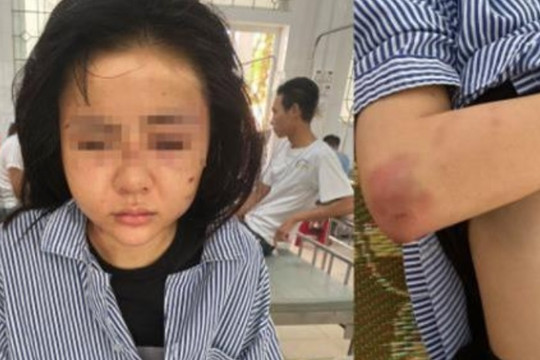 Yên Bái: Khởi tố kẻ đánh đập cô gái suốt 2 giờ đồng hồ