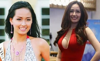 Mai Phương Thúy đã can thiệp bộ phận nào khi thừa nhận phẫu thuật thẩm mĩ?