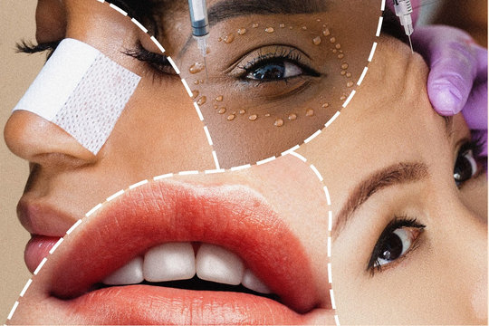 Tin vắn thế giới ngày 16/9: Phẫu thuật thẩm mỹ - "Hot trend" mùa COVID-19