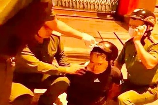 Đang ngủ, bất ngờ phục dậy đi lấy dao đâm bạn