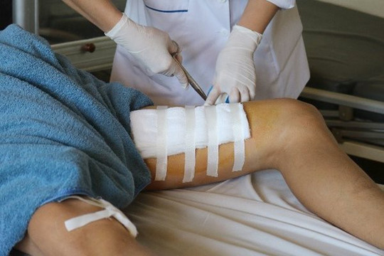 Bình rượu ngâm phát nổ, nam thanh niên bị đứt cơ đùi