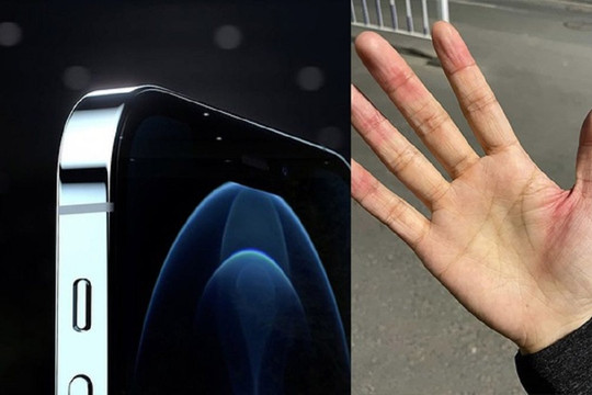 Người dùng phàn nàn vì iPhone 12 có cạnh quá sắc