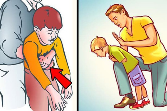 Phải làm sao khi trẻ bị sặc, hóc dị vật?