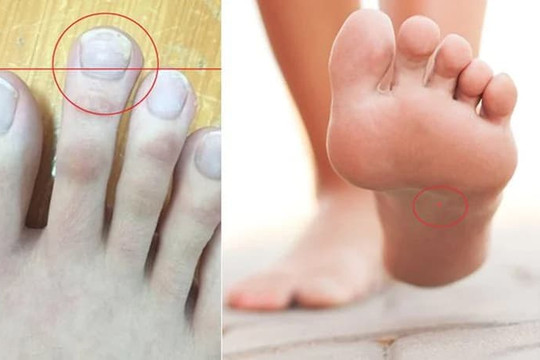 Tướng chân đàn ông số hưởng, cả đời sung sướng, sau 30 tuổi chắc chắn thành đạt