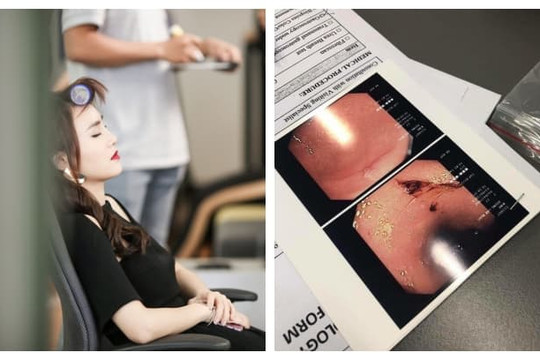 Cư dân mạng 'đào' lại ảnh Lan Ngọc kiệt sức ở phim trường, nội soi dạ dày bị viêm loét đến chảy máu