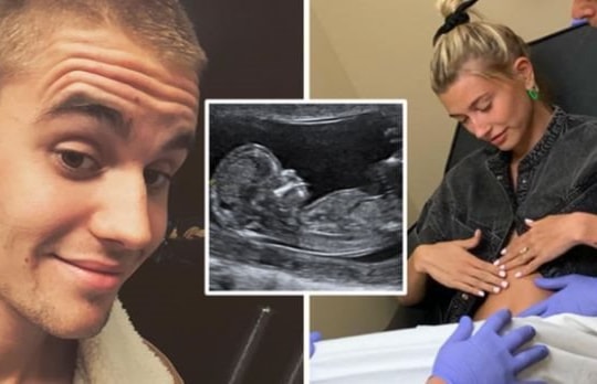 Vợ chồng Justin Bieber "dằn mặt" báo chí vì tin đồn mang thai