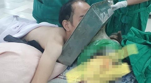 Nam thanh niên nhập viện với cánh tay bị máy xay thịt cuốn đến vai