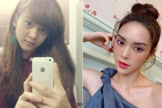 'Mẹ đơn thân' Quỳnh Lương treo thưởng 5 triệu đồng cho ai đưa ra bằng chứng 'dao kéo'