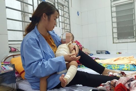 Chữa bỏng 25 triệu ở thầy lang, bé trai bị hoại tử phải ghép da