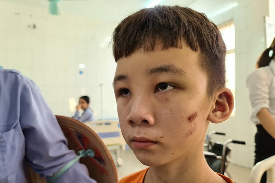 Bé trai bị chủ quán bánh xèo tra tấn: “Làm việc 20 tiếng, ăn đồ thừa của khách, ngủ trên nền đất lạnh”