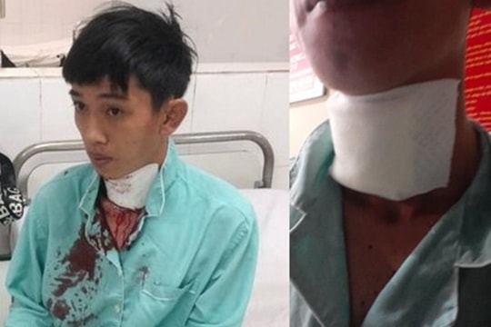 Lái xe ôm công nghệ suýt chết vì bị tên cướp cứa cổ