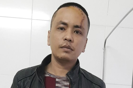 Đối tượng ngáo đá, đánh bố đẻ, chém công an xã trọng thương