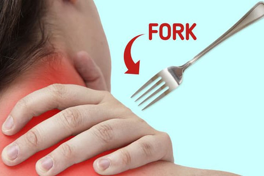 7 mẹo để thoát khỏi chứng đau cứng cổ, căn bệnh thường gặp của dân văn phòng