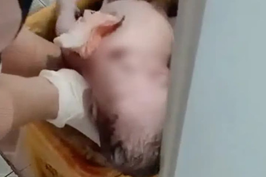 Nghẹt thở khoảnh khắc giải cứu bé sơ sinh bị mẹ 18 tuổi bỏ vào thùng rác bệnh viện