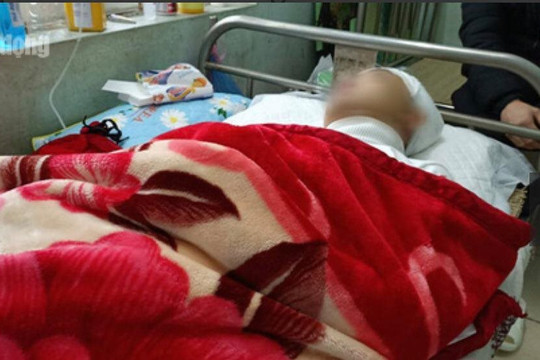 Xác minh vụ việc nam sinh lớp 11 bị đánh chấn thương sọ não
