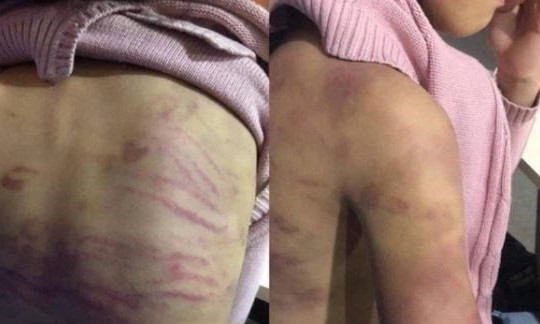 Khởi tố mẹ và người tình bạo hành, xâm hại bé gái 12 tuổi 