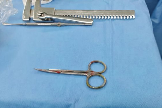 Nam bệnh nhân nhập viện trong tình trạng kéo đâm xuyên cổ họng