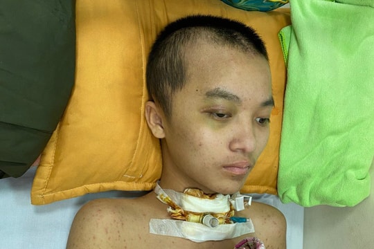  Xót xa hoàn cảnh bé trai bị chấn thương sọ não do tai nạn giao thông
