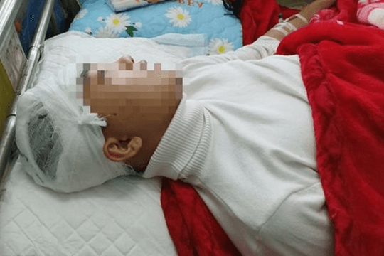 Thanh Hóa: Khởi tố, bắt giam nam sinh lớp 11 đánh bạn học vỡ sọ não