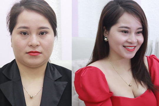 Bắt kịp xu hướng làm đẹp 2021: Nâng cơ, thon gọn gương mặt không cần phẫu thuật