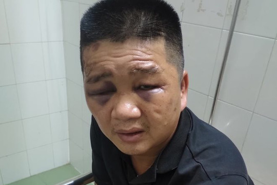 Tạm giữ hình sự đối tượng móc cốp xe trộm hơn 100 triệu