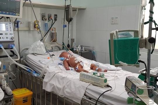Bệnh nhi 9 tháng tuổi nguy kịch do sốc sốt xuất huyết 