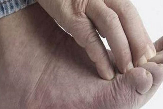 Nếu bốn tình trạng này xảy ra trên bàn chân, đó có thể là dấu hiệu của một căn bệnh nghiêm trọng mà hầu hết mọi người không nhận ra