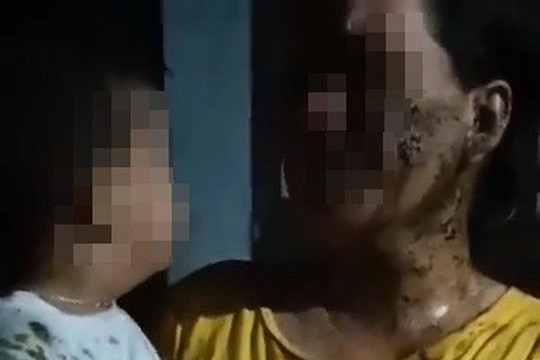 Bé 2 tuổi bị đổ phân lên người vì mâu thuẫn giữa người lớn