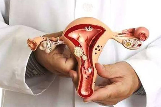 Hai cơn đau này trên cơ thể phụ nữ có thể là “gióng lên hồi chuông báo động” ung thư cổ tử cung, hãy biết và phòng tránh sớm