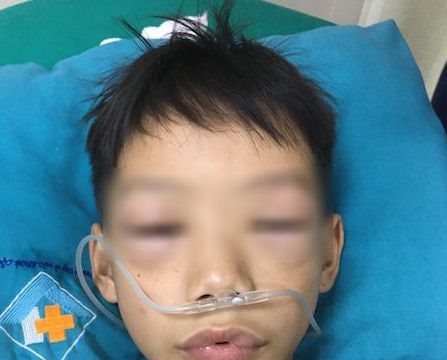 Bé trai 10 tuổi bị sốc phản vệ nặng do uống thuốc tự mua