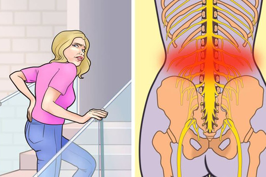 6 thói quen gây đau thắt lưng dưới và đây là cách phòng tránh