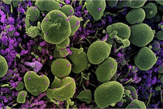 Tin vắn thế giới ngày 15/5: Giới khoa học Thụy Sĩ tìm ra "gót chân Achilles" của virus SARS-CoV-2