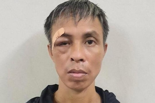 Dùng mảnh gương đâm chết bệnh nhân cùng phòng