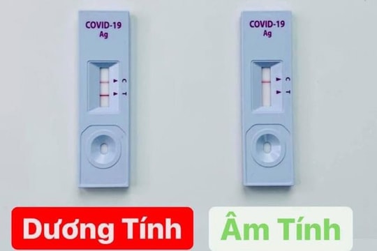 Thực hư công dụng bộ kit test nhanh Covid-19 được rao bán tràn lan trên mạng?