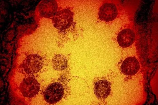 Tin vắn thế giới ngày 31/7: Nguy cơ xuất hiện những biến thể nguy hiểm mới của virus SARS-CoV-2