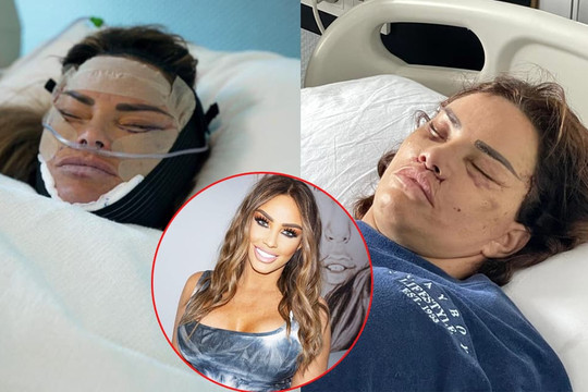 Cựu ‘bom sex’ Katie Price lại ‘trùng tu’ nhan sắc sau hàng loạt ca phẫu thuật thảm họa