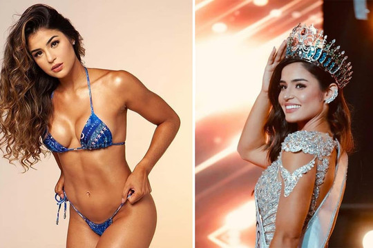 Người đẹp từng bị ung thư tuyến giáp trở thành Hoa hậu Thế giới Brazil 2021