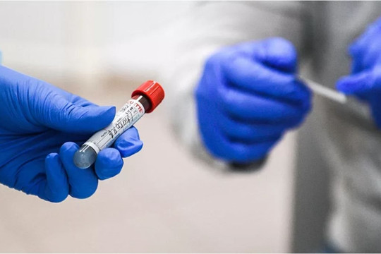 Nga phát triển thiết bị phát hiện virus SARS-CoV-2 trong vòng 27 phút