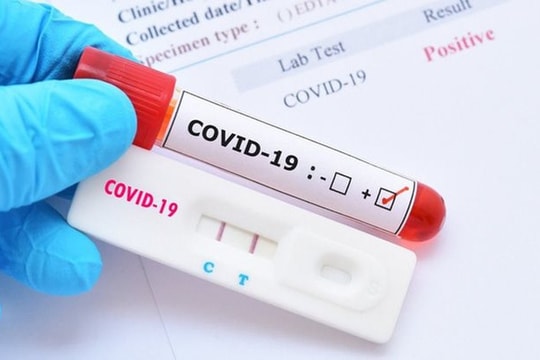 Bộ Y tế nói gì về test nhanh Covid-19 mua ở nước ngoài chỉ 35.000 đồng?