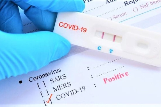 Chuyển điều tra nếu phát hiện dấu hiệu hình sự trong kinh doanh xét nghiệm COVID-19