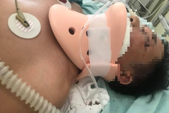 Khởi tố 2 bị can đánh người trước cổng VKSND huyện Phúc Thọ