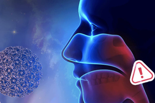 'Ung thư hầu họng' liên quan đến HPV đã vượt qua ung thư cổ tử cung! Nam giới có nguy cơ cao hơn phụ nữ