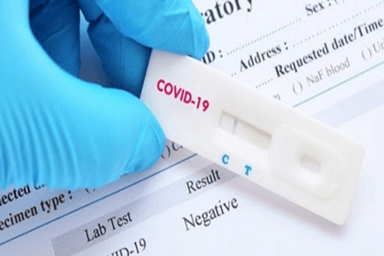 Bộ Y tế: Giá test nhanh Covid-19 tối đa 109.700 đồng/xét nghiệm